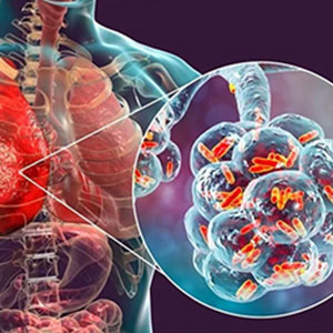 Pneumonia specialist in Vijayawada