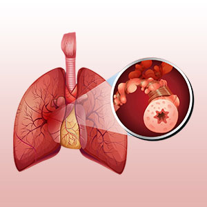 COPD treatment